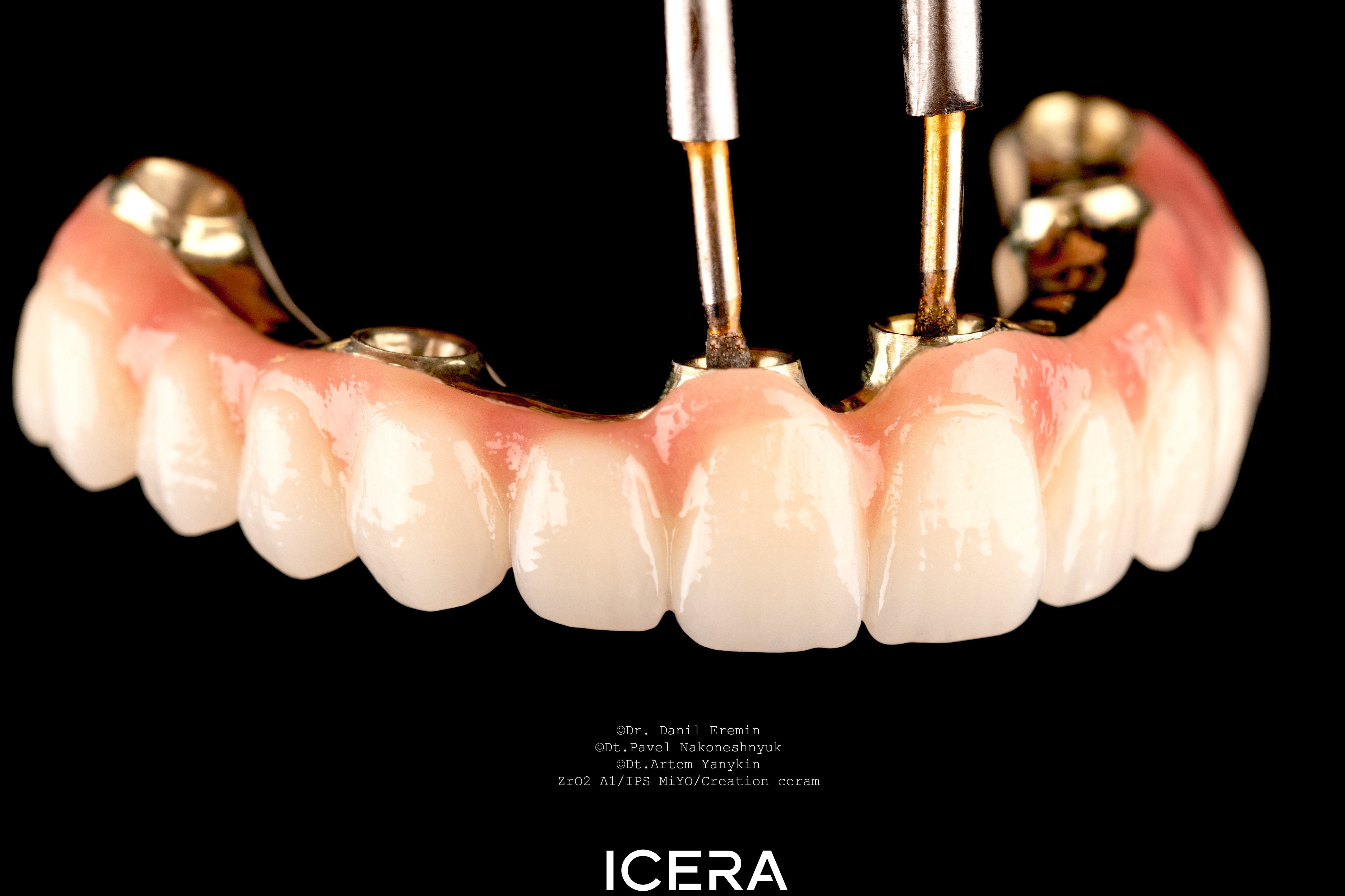 Unmatched Strength and Aesthetics in Zirconia Dental Bridges