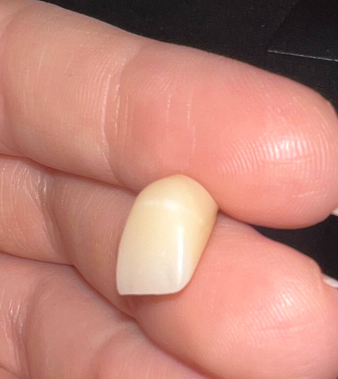 Why Do White Lines Appear After Zirconia Sintering? A Manufacturer’s Perspective