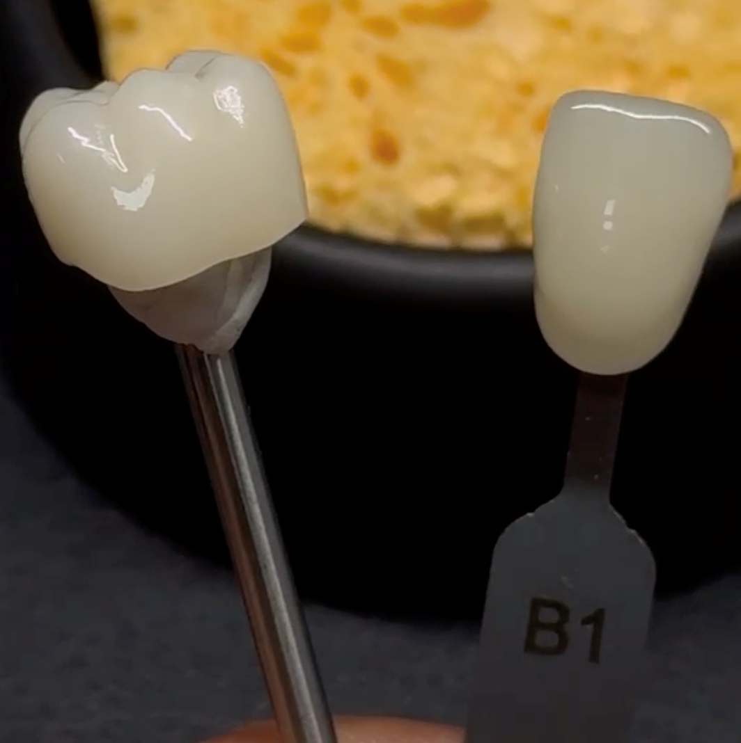When the Gradient Goes Wrong: Colour Transition in Multilayer Zirconia After Sintering