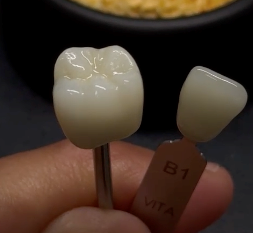 When the Gradient Goes Wrong: Colour Transition in Multilayer Zirconia After Sintering