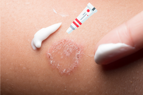 miconazole cream supplier.png