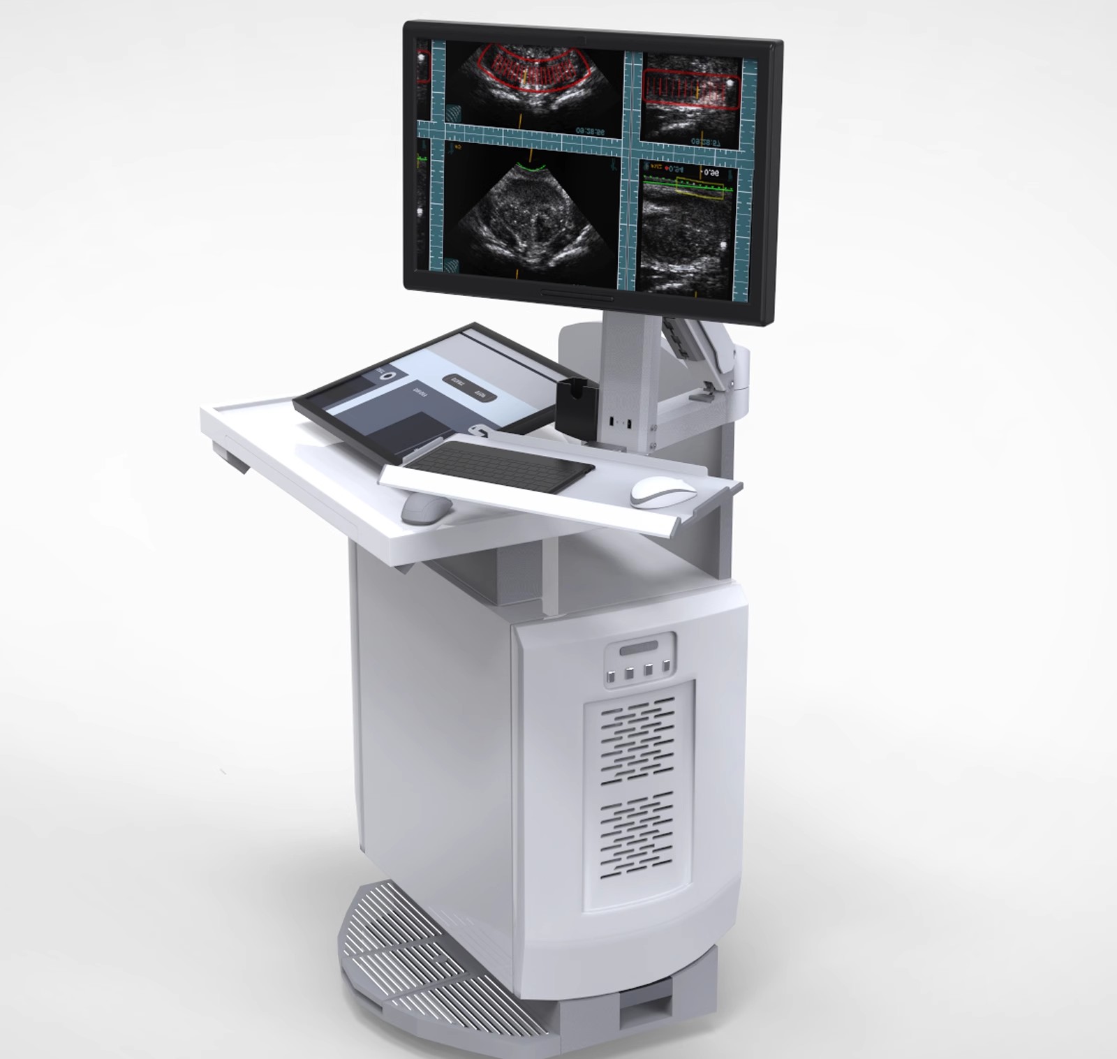 Smart Mounting Solutions for Anesthesia Workstations in Healthcare Environments