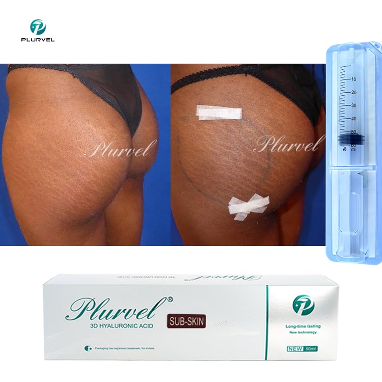 Plurvel Medical 50cc Liggaamsvulmiddel Hialuronzuur Injections Lang Laastende Bilvulmiddel vir Bilvergroting Heup Op