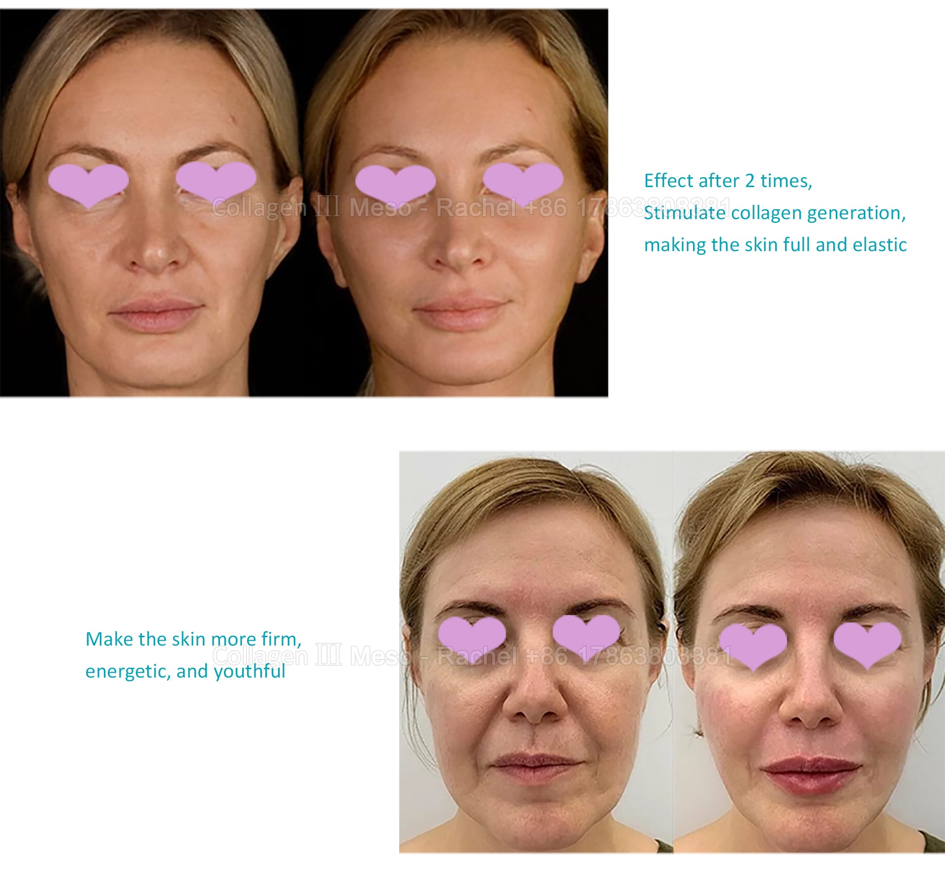 collagen-psd_04.jpg