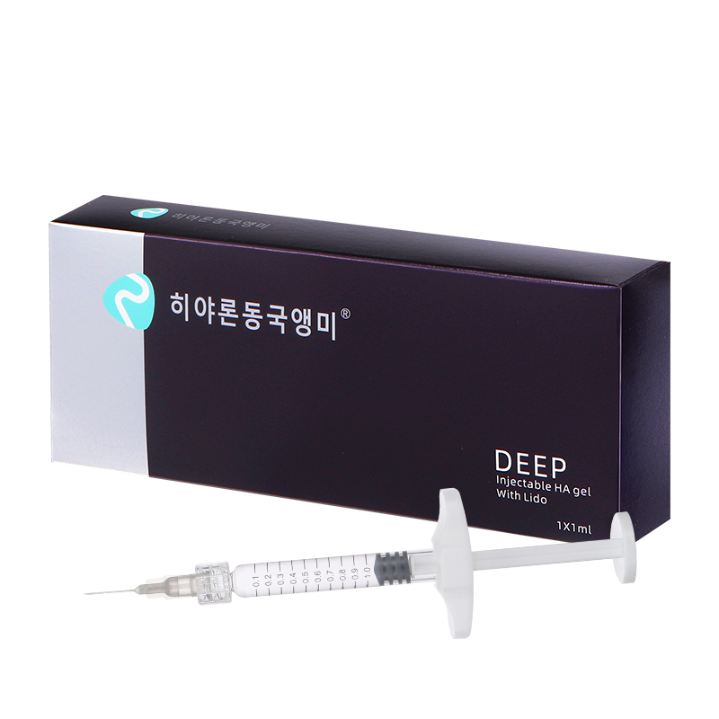 hyaluron Dongguan Anchor® DEEP #1 spuitbare HA gelsuif met Lido