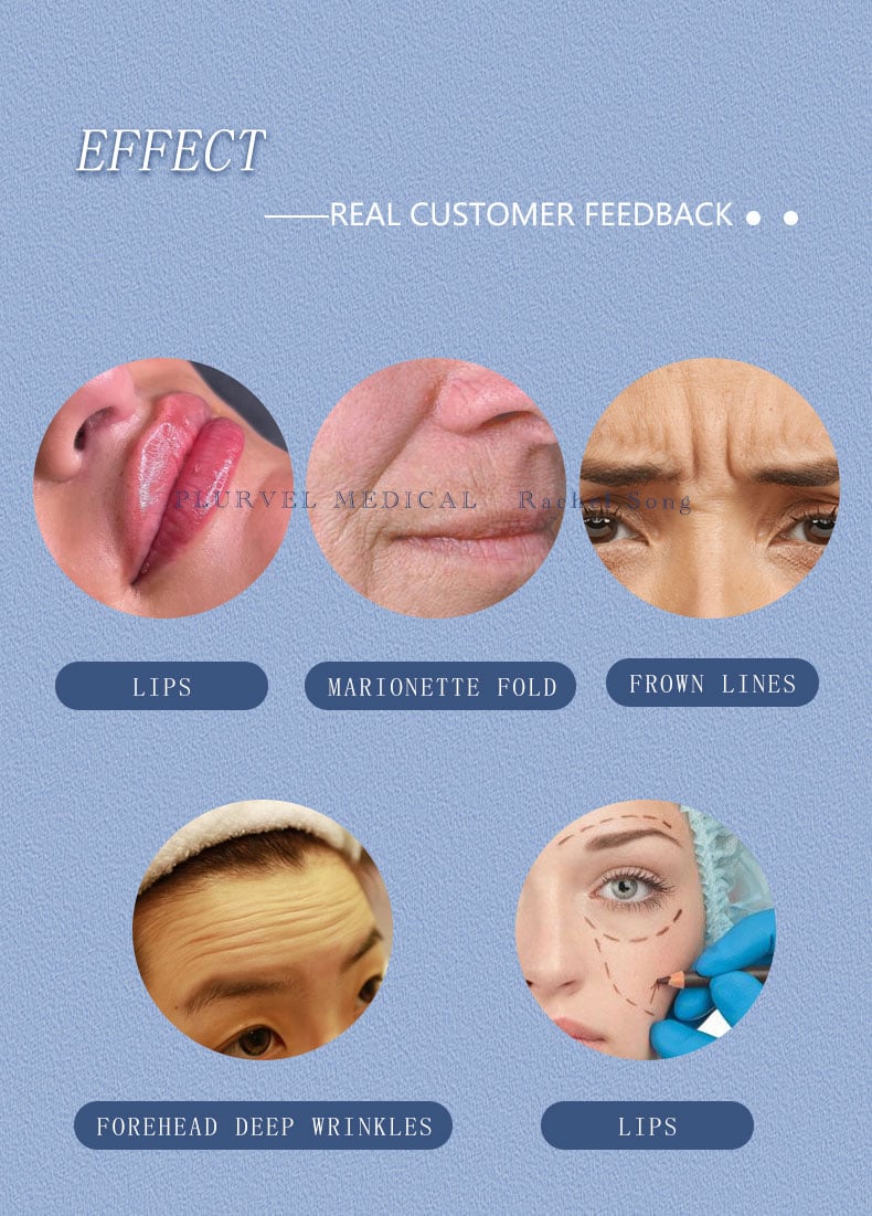 Plurvel 1ml Derm旧版 详情页 (7).jpg