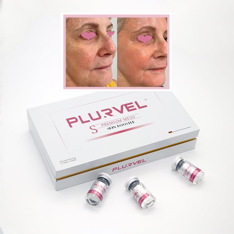 Fabriek Hialuronzuur Velversterkende Injekteerbare Mesoterasie vir Aftesting Verjonging Bleiking Vochtbehoud Herstel