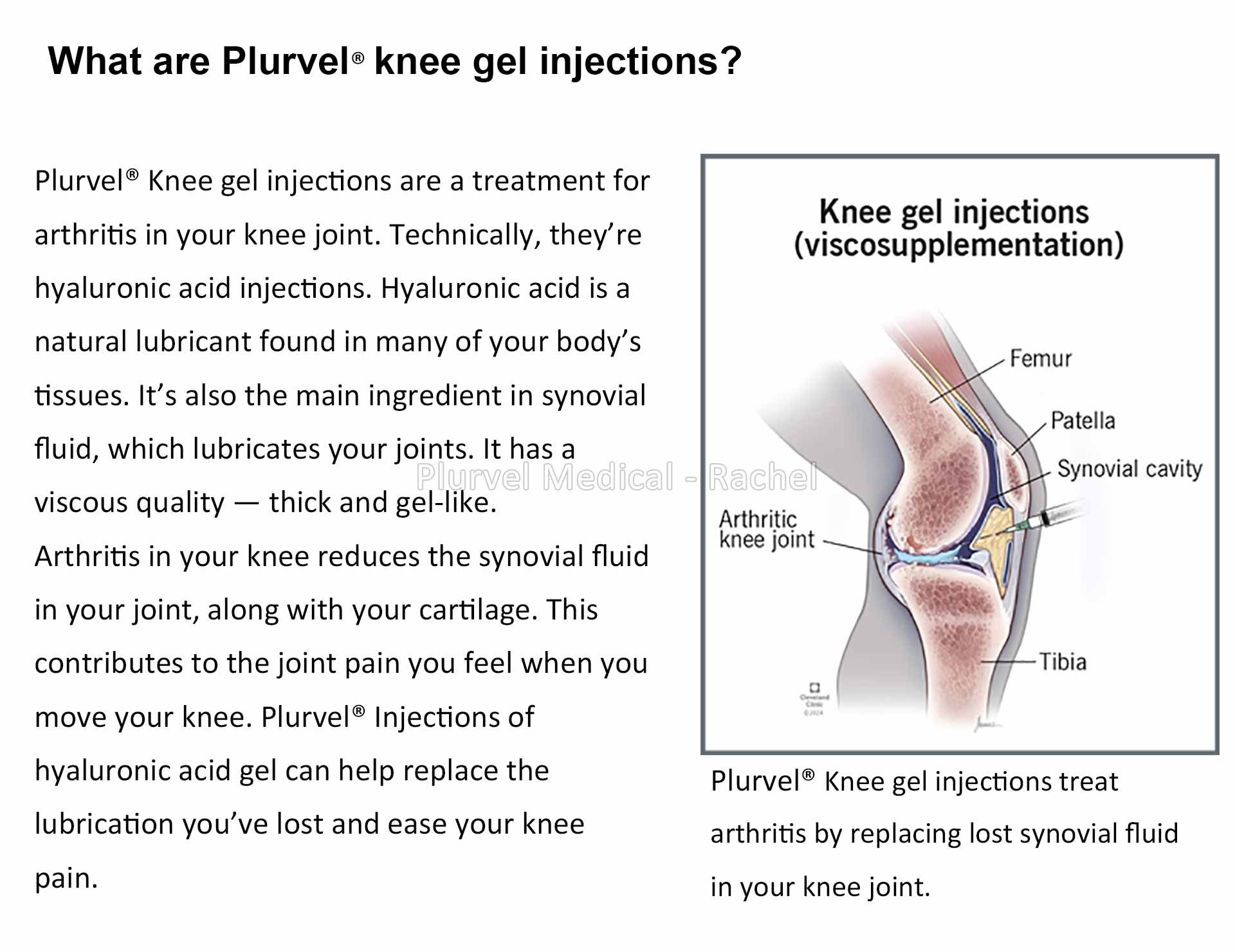 Rachel - Plurvel Knee (2).jpg