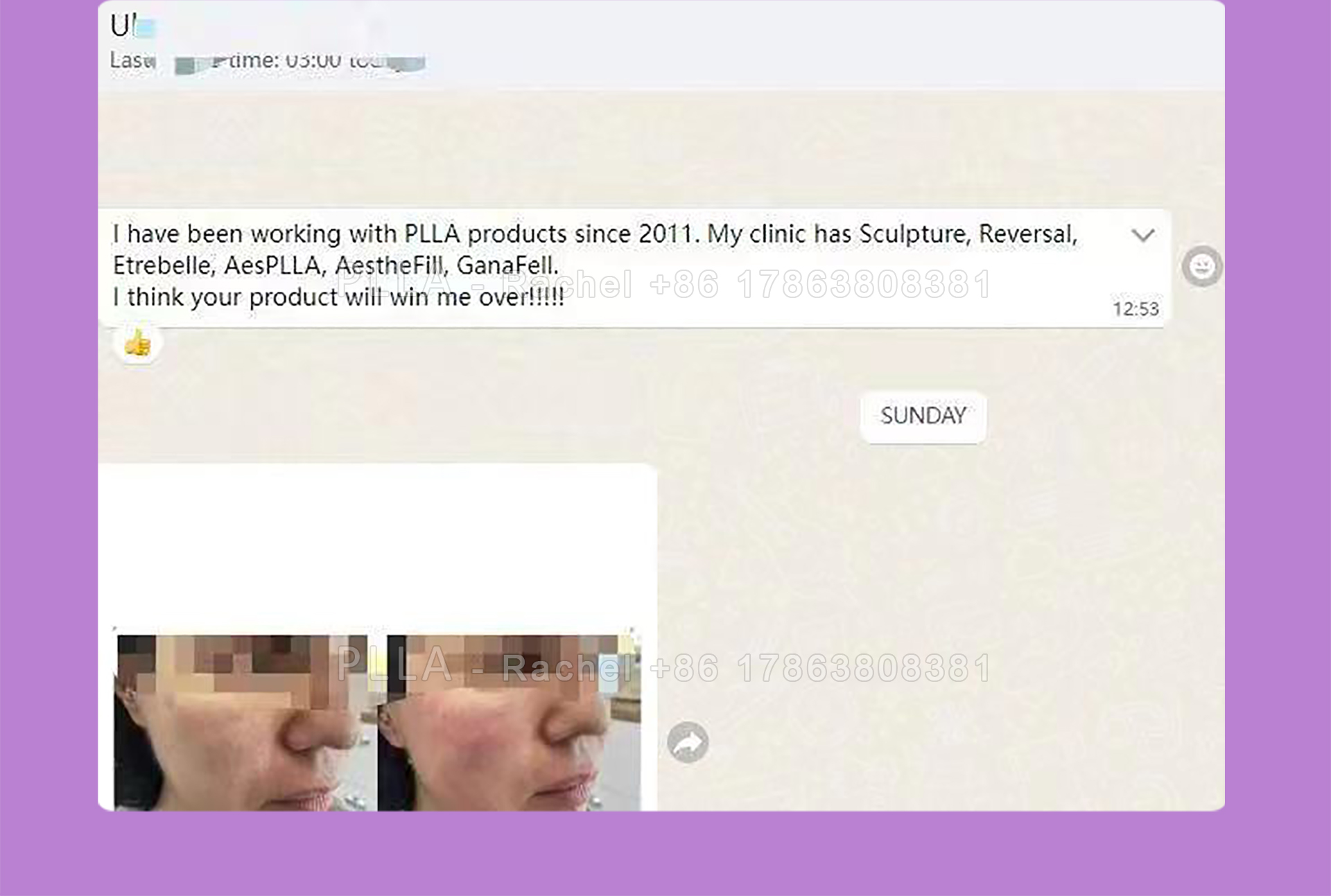 PLLA_09.jpg