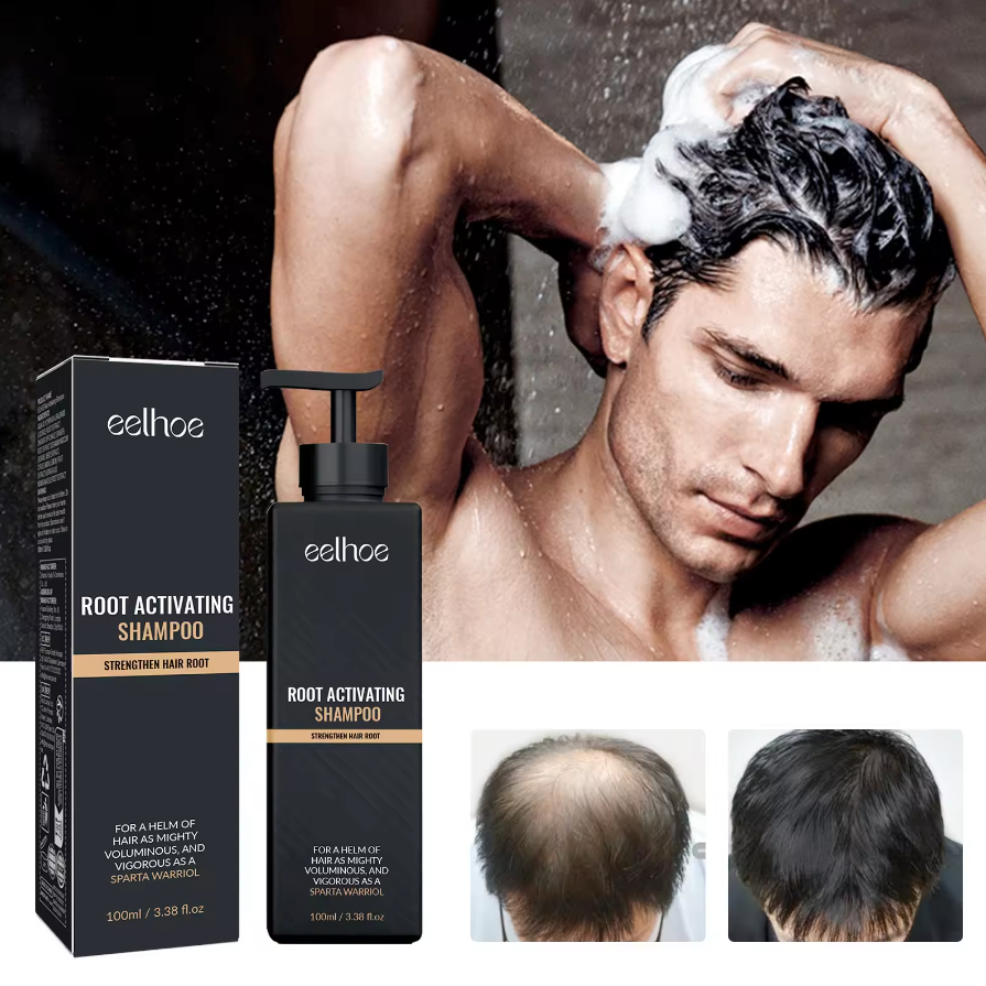Dropshiping Wholesale Custom Logo Hair Growth Shampoo Strong Repair Tight Hair Shampoo Base Root Activating Anti Hair Loss Shampoos for Men