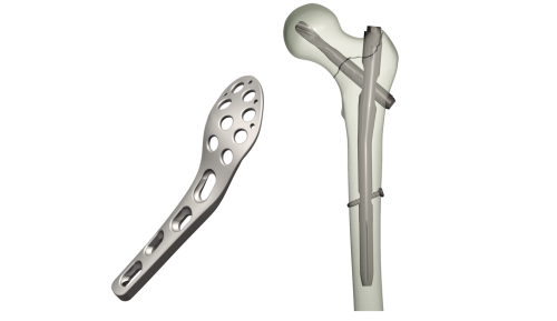 Implant Machining