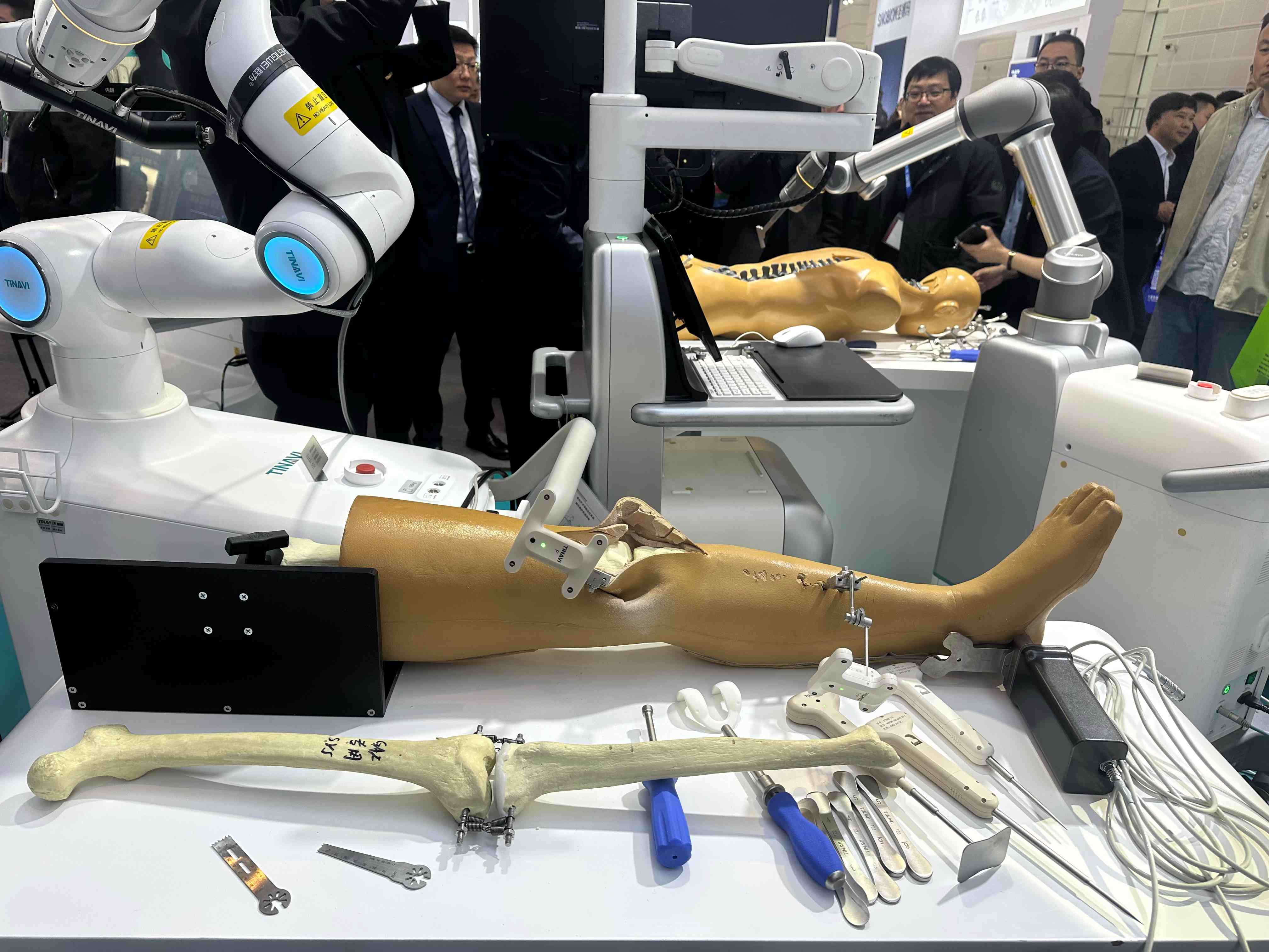 Taruk Leadership Explores Orthopaedic Innovation and Customer Collaboration at COA 2025 in Tianjin-6