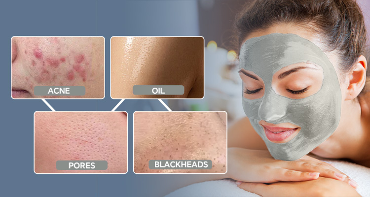 Dead Sea Mud Clay Mask | Deep Cleansing & Soothing Facial Mask | OEM/ODM manufacture