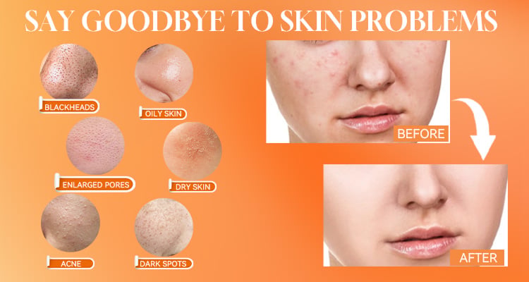 Vitamin C Turmeric Clay Mask – Brightening & Deep Cleansing Facial Mask | OEM/ODM details