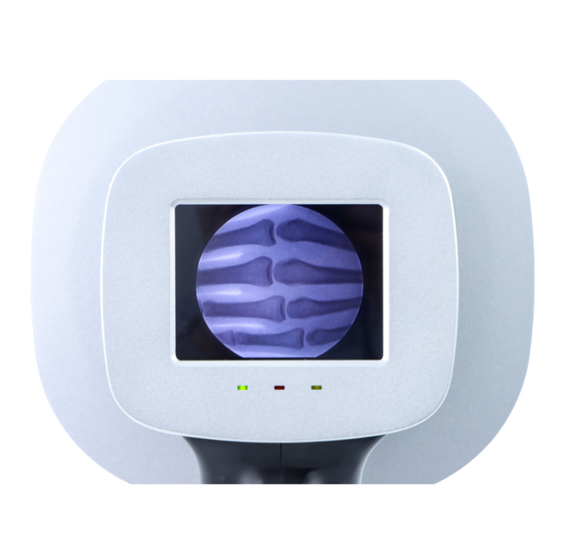 Why Is Portable X Ray Machine Essential for Field Medical Care?
