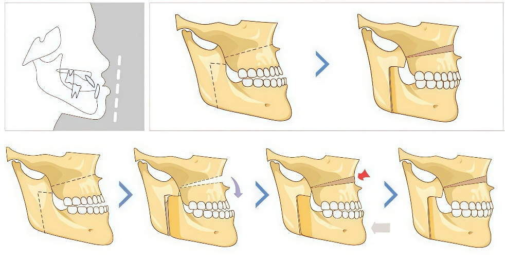 The Era of Precision Medicine in Minimally Invasive Maxillofacial Surgery