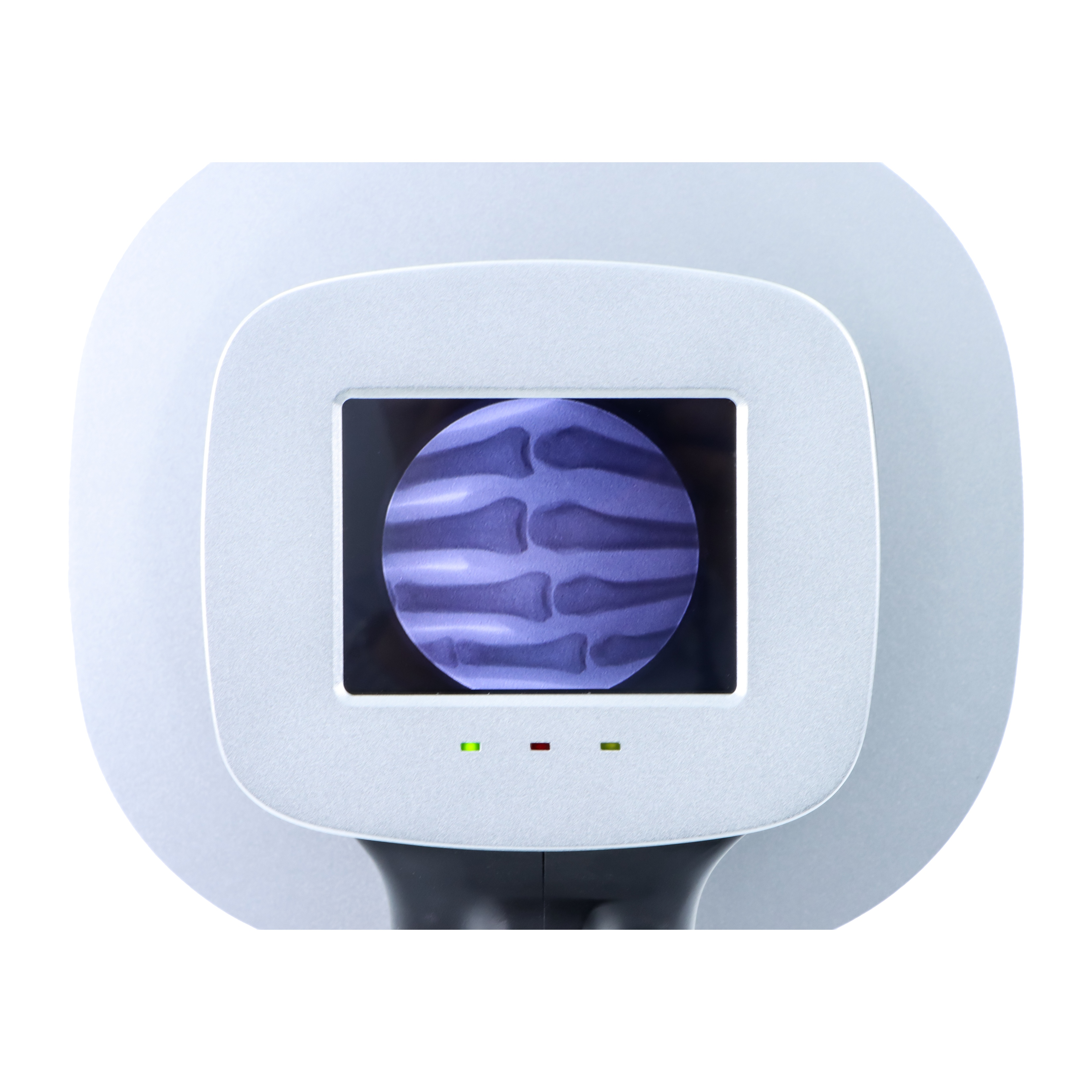 Why Is Portable X Ray Machine Essential for Field Medical Care
