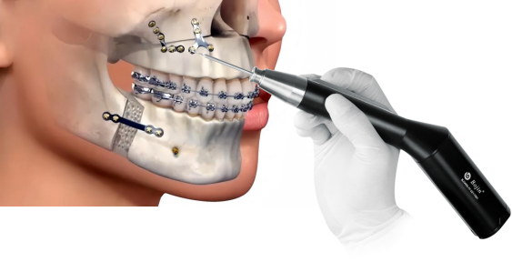 The Era of Precision Medicine in Minimally Invasive Maxillofacial Surgery