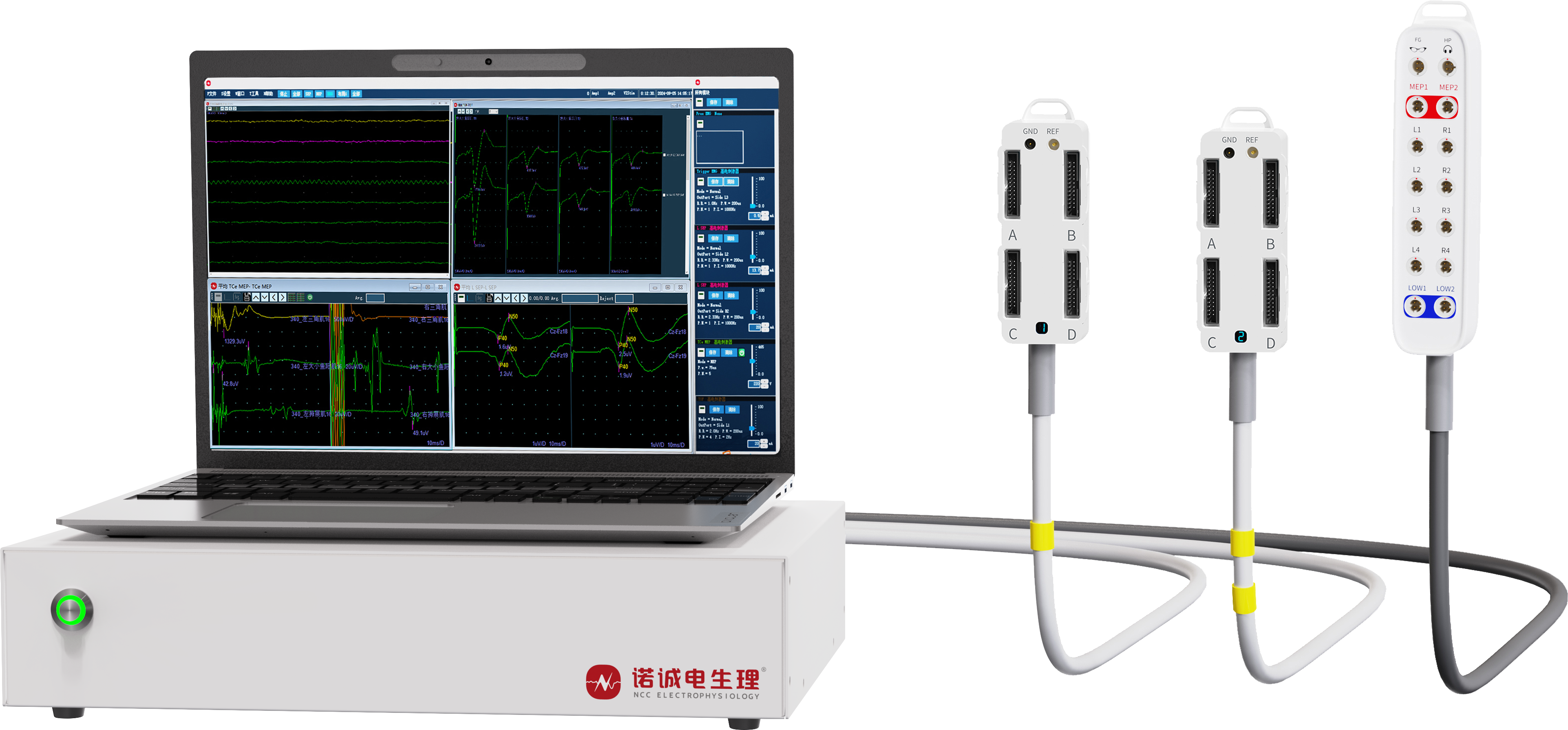 Compliance Requirements and Clinical Application Value of Intraoperative Neurophysiological Monitoring