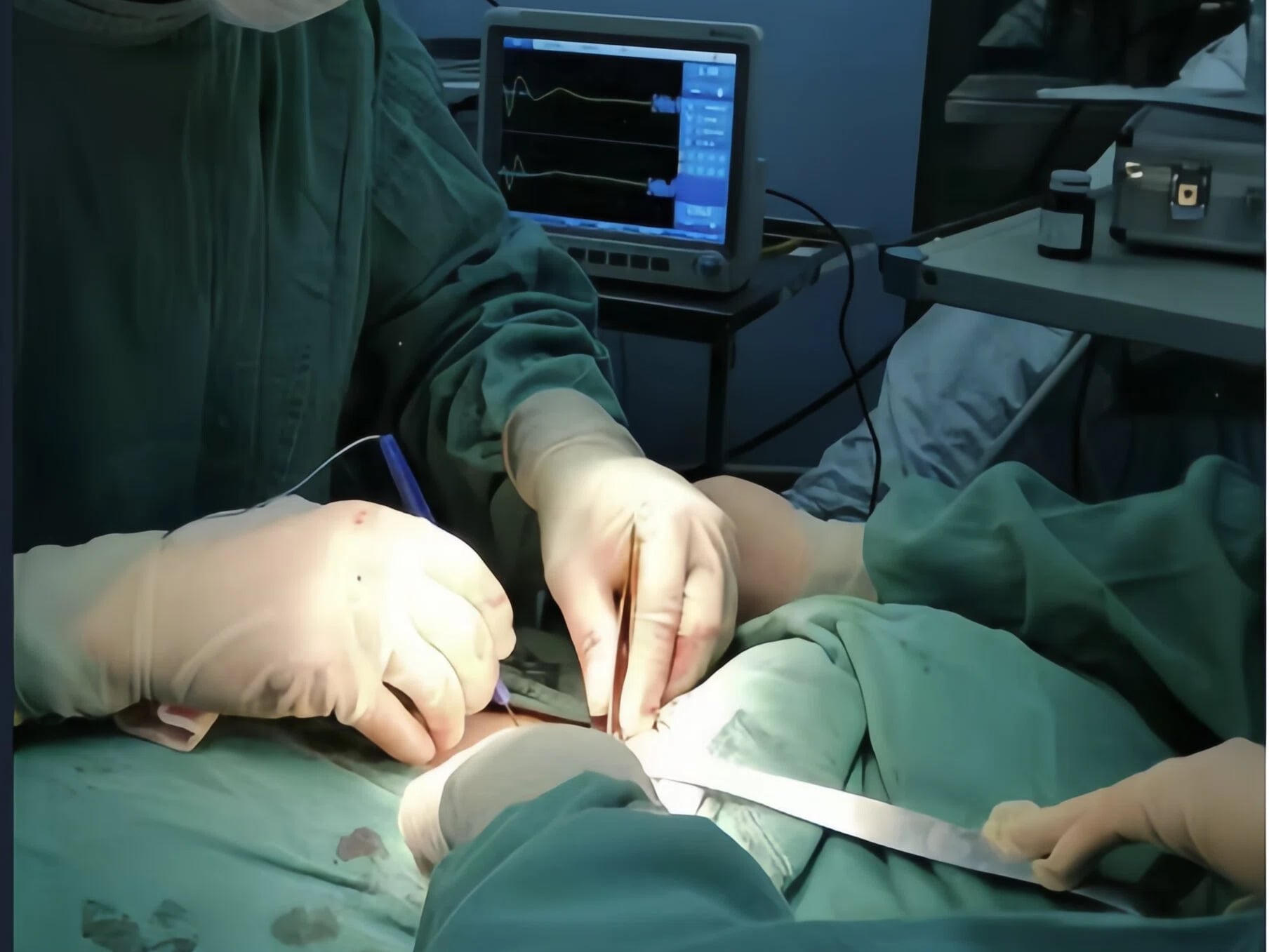 Intraoperative Neuromonitoring Report for Thyroid Surgery