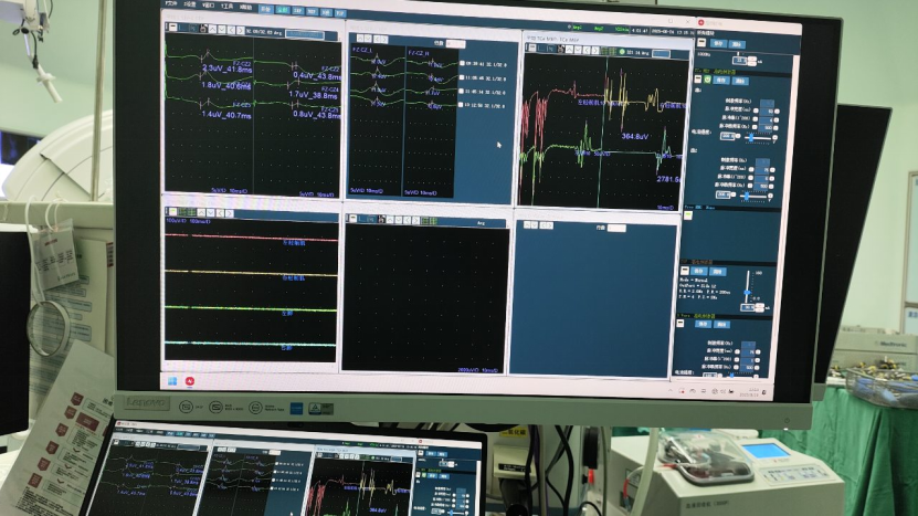 Intraoperative Neurophysiological Monitoring Report