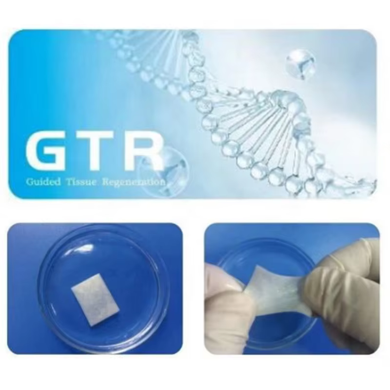 The Biological Mechanism behind Guided Bone Regeneration