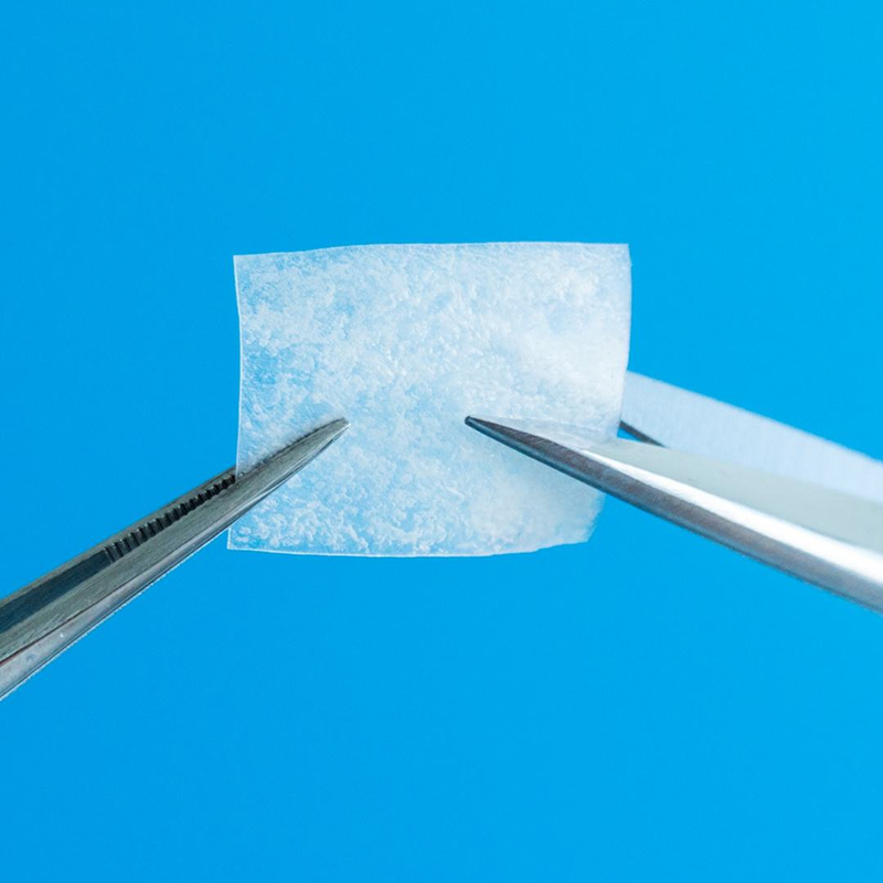 Which Procedures Commonly Require a Dental Membrane for Support?
