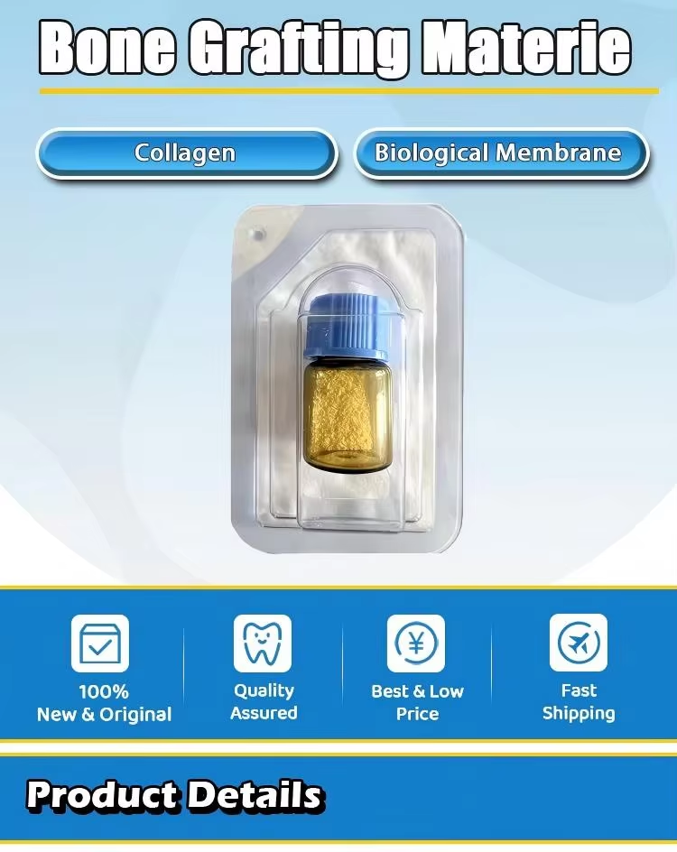 How to Choose the Right Bone Graft Material for Dental Surgery?