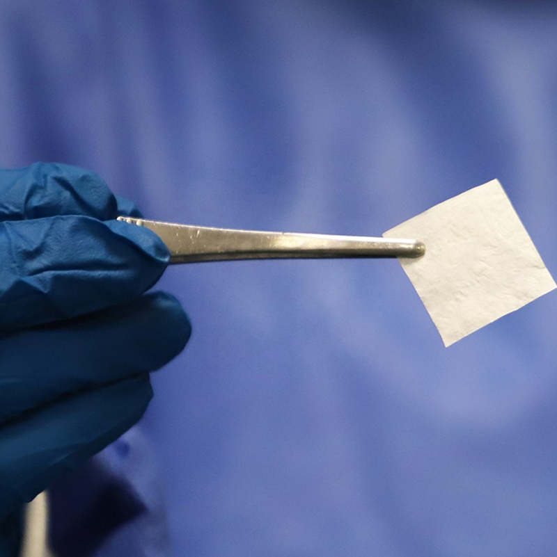 Biocompatibility and Natural Resorption