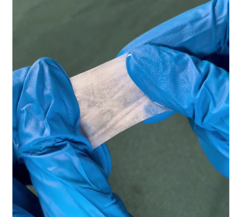 Cost-Effective Solution Eliminating Secondary Surgery