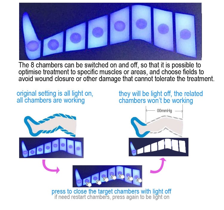 Intensive and Skip Care Functions