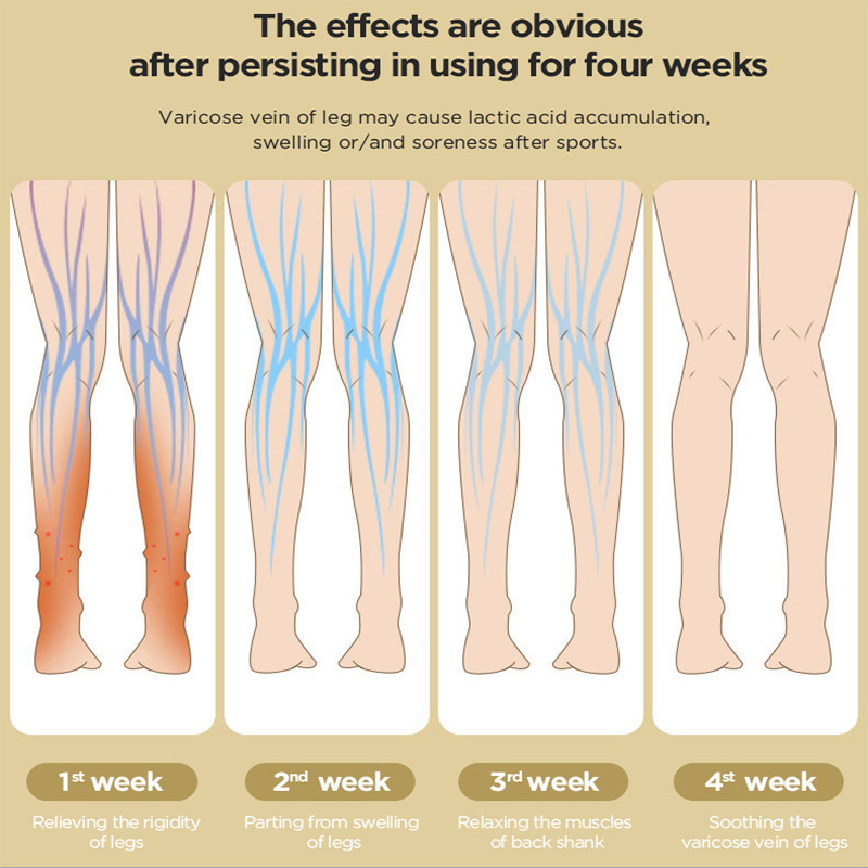 Portable 5-Chamber Air Compression Leg Massager for DVT Prevention