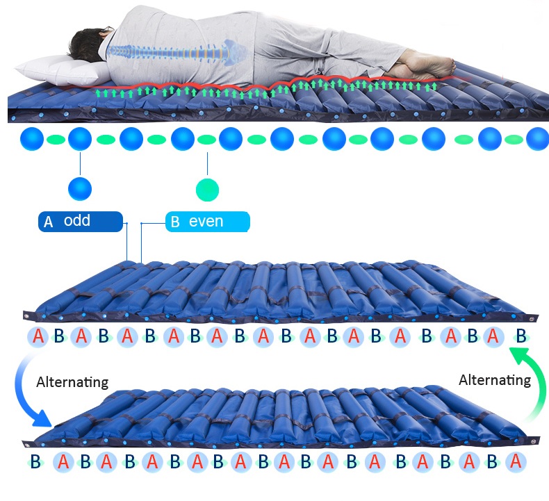 Silent Alternating Pressure Redistribution