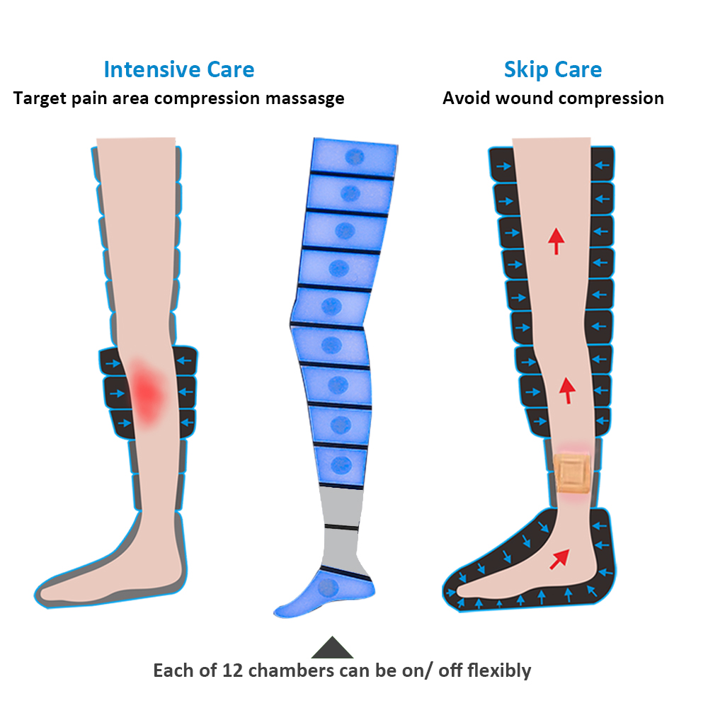 "Skip Care" and "Intensive Care" Functions
