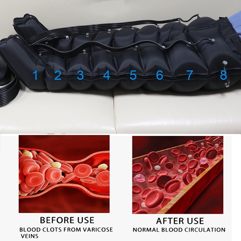 VU-IPCA8 8 Chamber Compression Pants | Rechargeable Air Compression Massager