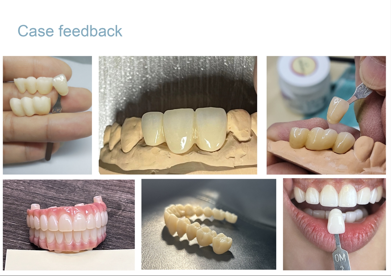 Zirconia Block supplier