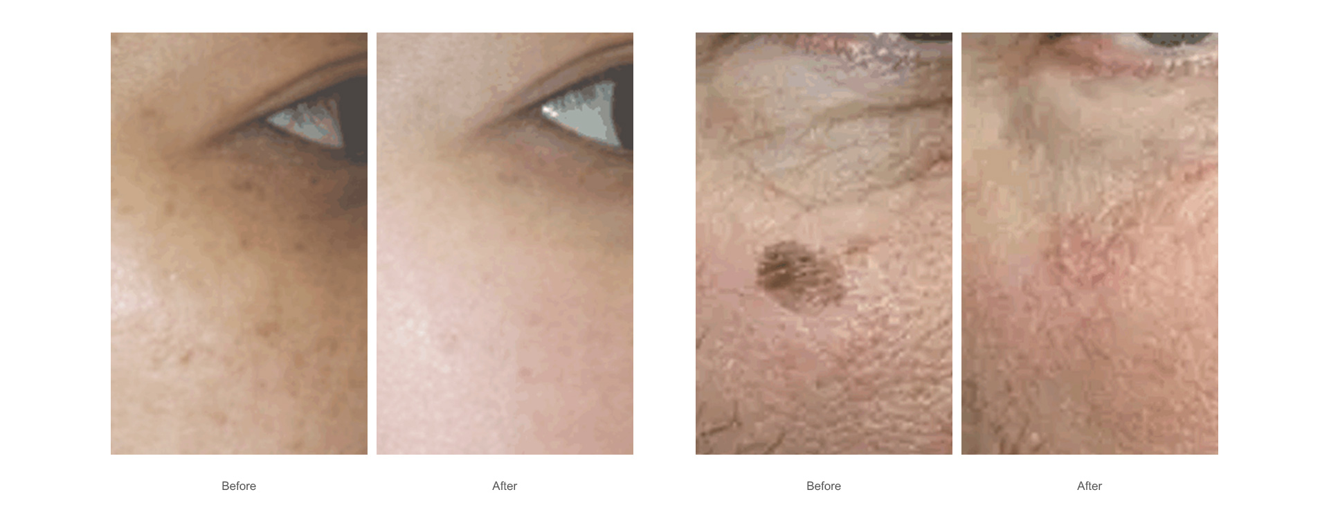 pigmentation disorders-1