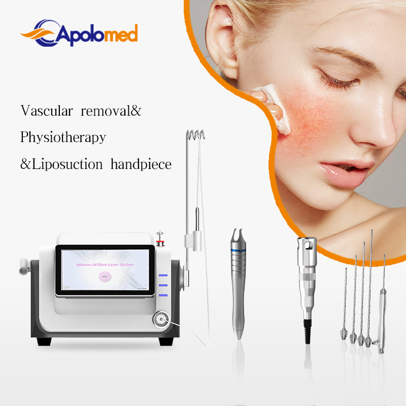 Revolutionizing Aesthetic Treatments with Laser Endolift