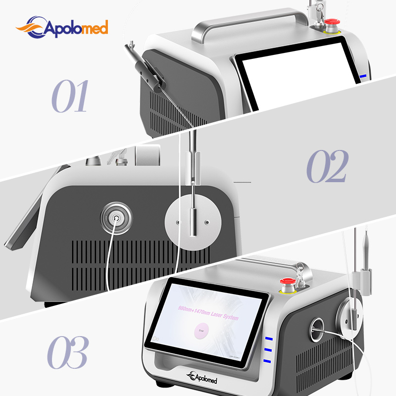 Advanced Endolaser Varicose Solutions for Effective Treatment