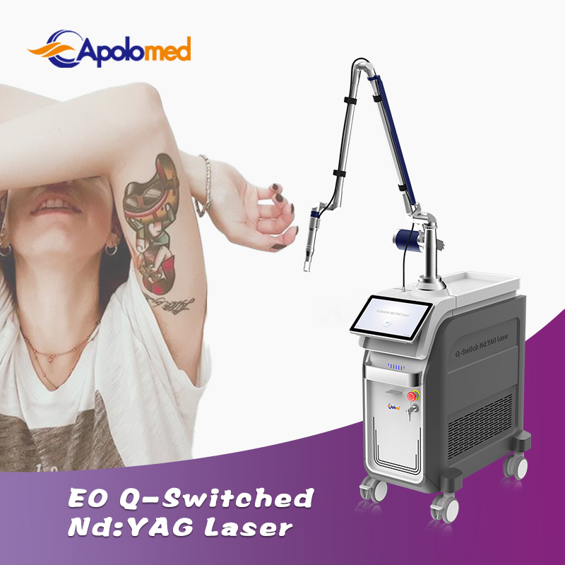Advanced Q Switch Tattoo Removals for Flawless Skin