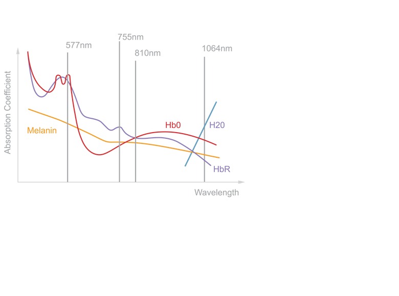 Diode laser hair removal wavelength chart