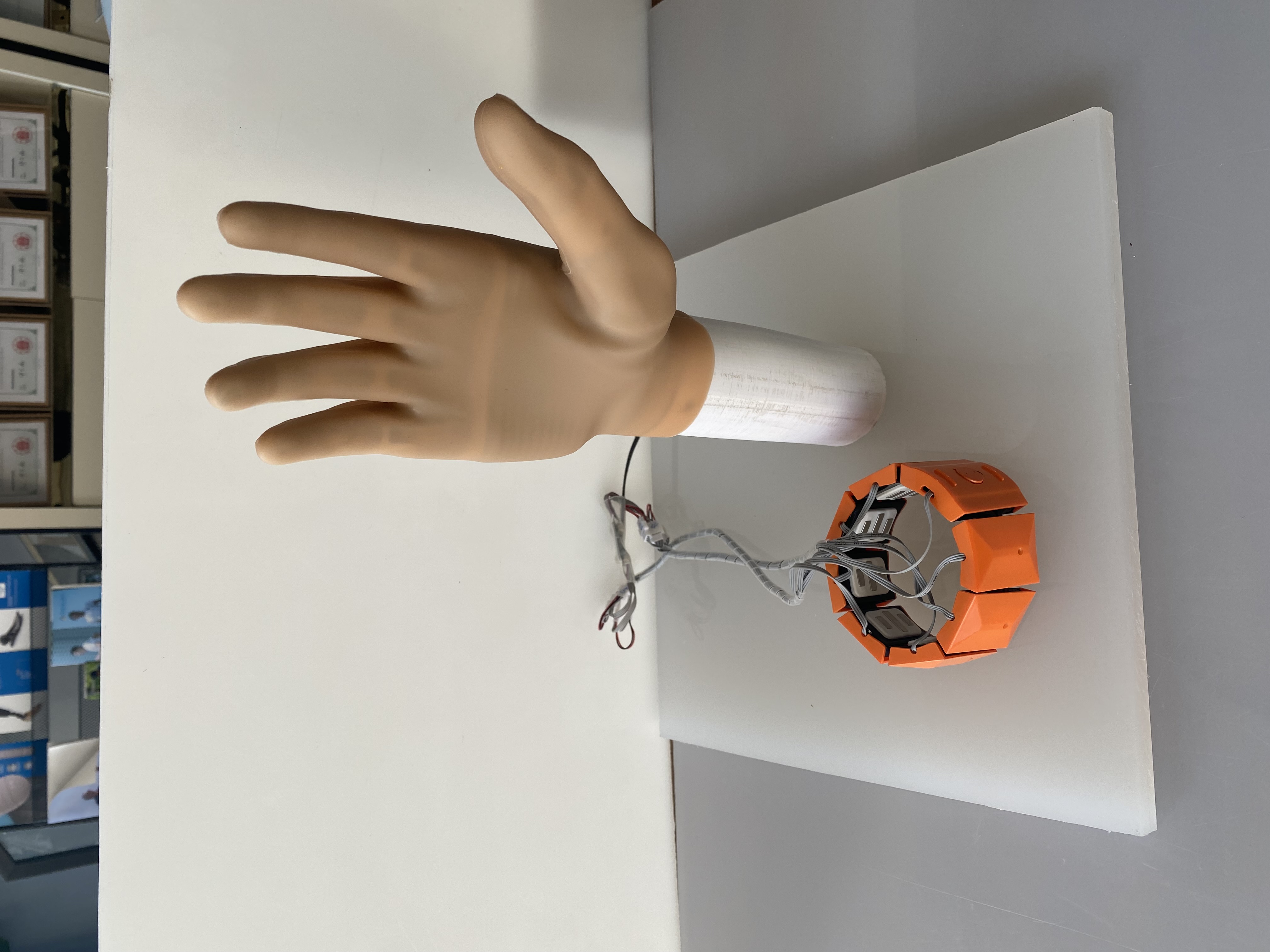 Carbon Fiber Bionic Smart Hand: Lightweight & Durable Prosthetic