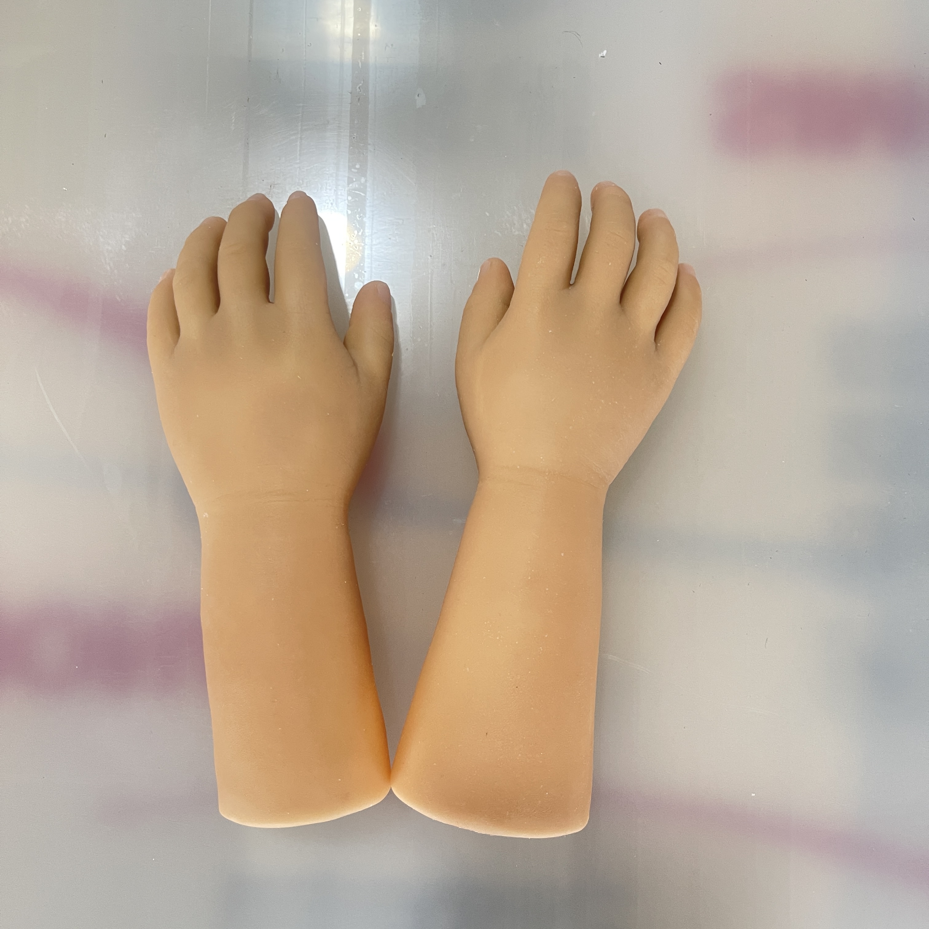 Our Prosthetic Hand: Trusted Quality for Restored Independence