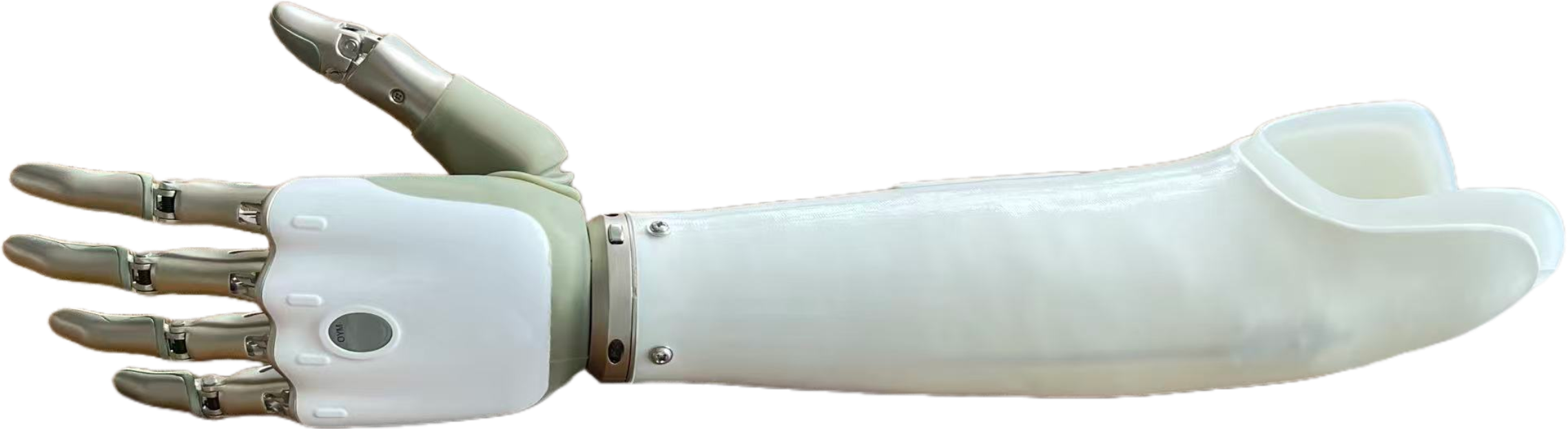 Myoelectric Bionic Smart Hand: Intuitive Control for Daily Independence