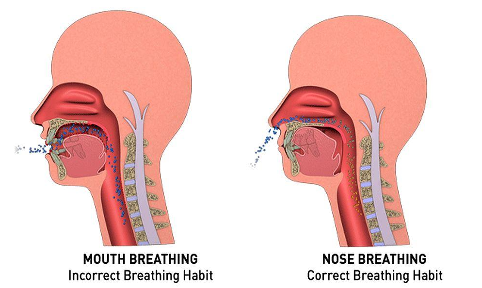 mouth tape for sleep apnea does it really work-2
