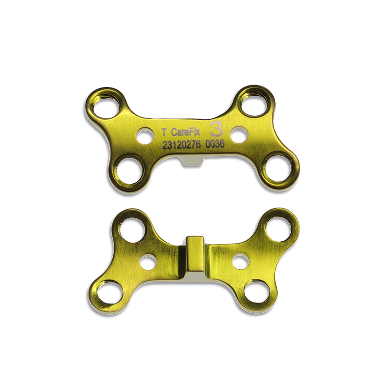 Opening Wedge Ⅱ Locking Plate  2.4/2.7mm