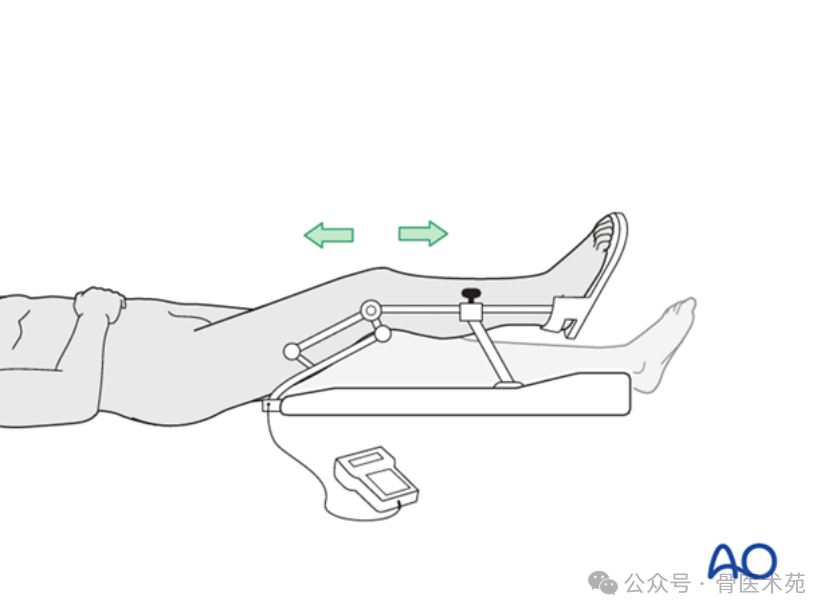 Open Reduction and Internal Fixation of Hoffa Fracture with Plate and Screws