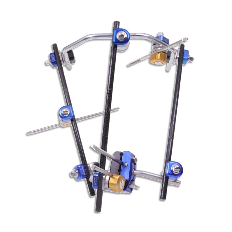 Combined brace: multi-mode fracture fixation to facilitate clinical minimally invasive treatment