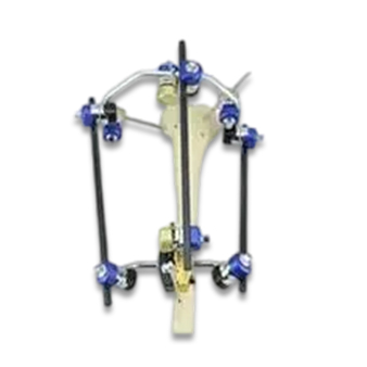 Combined External Fixator