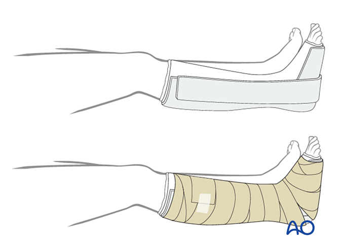 IV. Approach Preparation